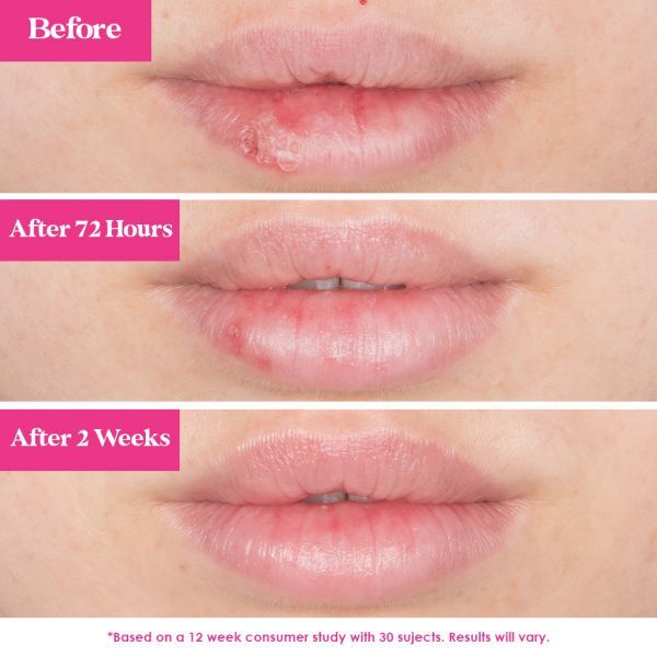GrandePOUT Plumping Lip Mask Peach - Bilde 2